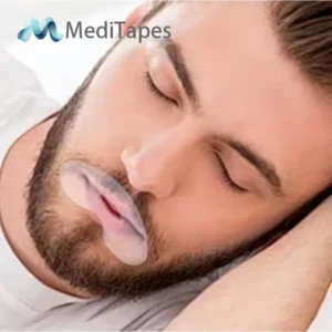 Transparent Medical PE Mouth Tape 3.3x5cm - Professional Sleep Aid